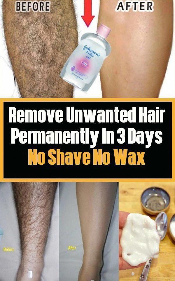 Remove Unwanted Hair Permanently In Three Days No Shave No Wax Removal Facial And Body Hair