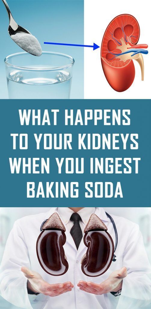 what-happens-to-your-kidneys-when-you-ingest-baking-soda